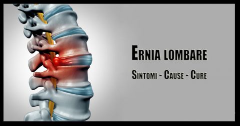 Ernia Lombare Sintomi E Cure Medicinafisica It