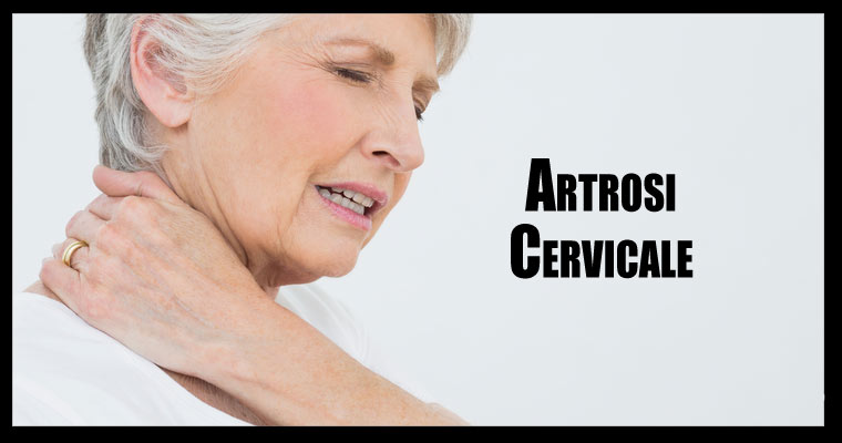 artrosi cervicale